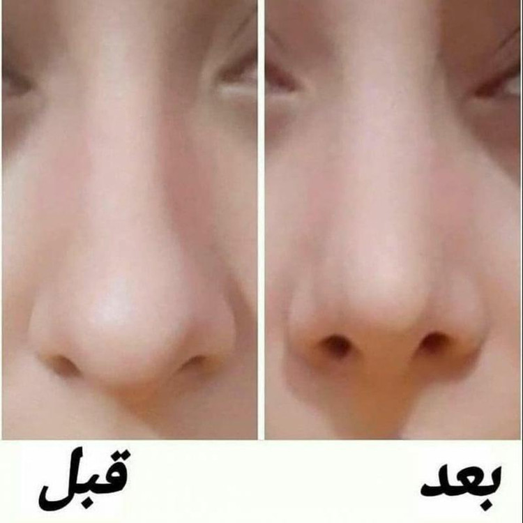 چسب لیفت و فرم دهنده بینی مدل بی رنگ (نامرئی)